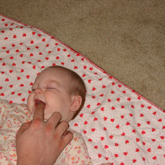 aubri getting gum treatment.jpg